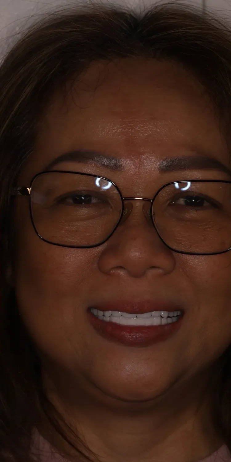 After: patient smiling with a complete smile